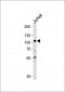 HK2 (Hexokinase II) Antibody (Center)